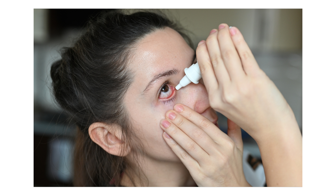 Eye drops to ease glaucoma symptoms.