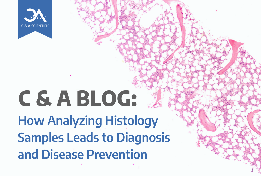 How Analyzing Histology Samples Leads to Diagnosis and Disease Prevention