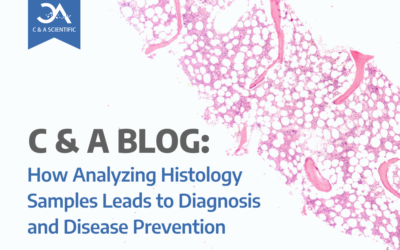 How Analyzing Histology Samples Leads to Diagnosis and Disease Prevention