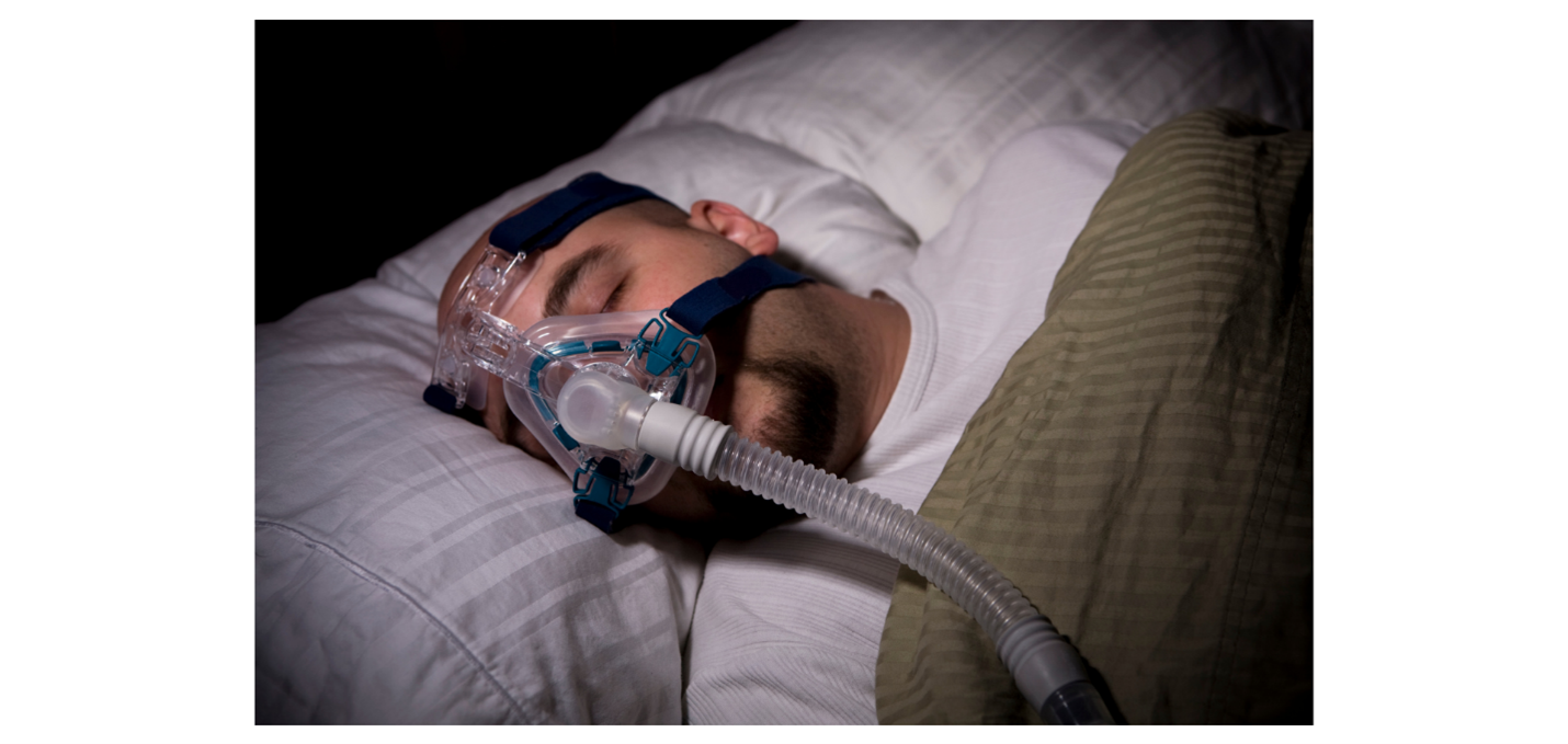 Sleep apnea caused by secondary hypertension.